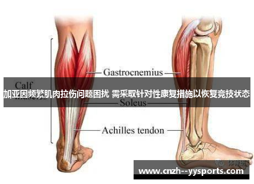 加亚因频繁肌肉拉伤问题困扰 需采取针对性康复措施以恢复竞技状态
